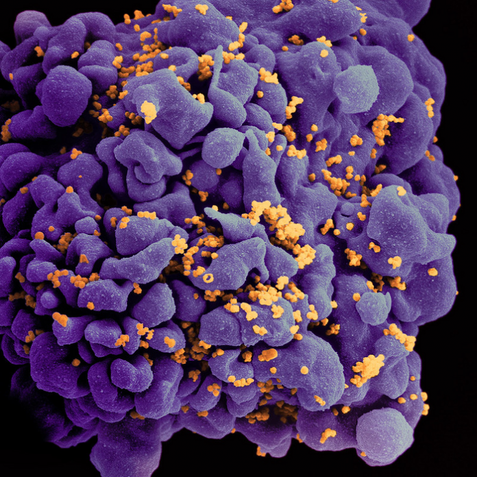 Scanning electron micrograph of an HIV-infected H9 T cell