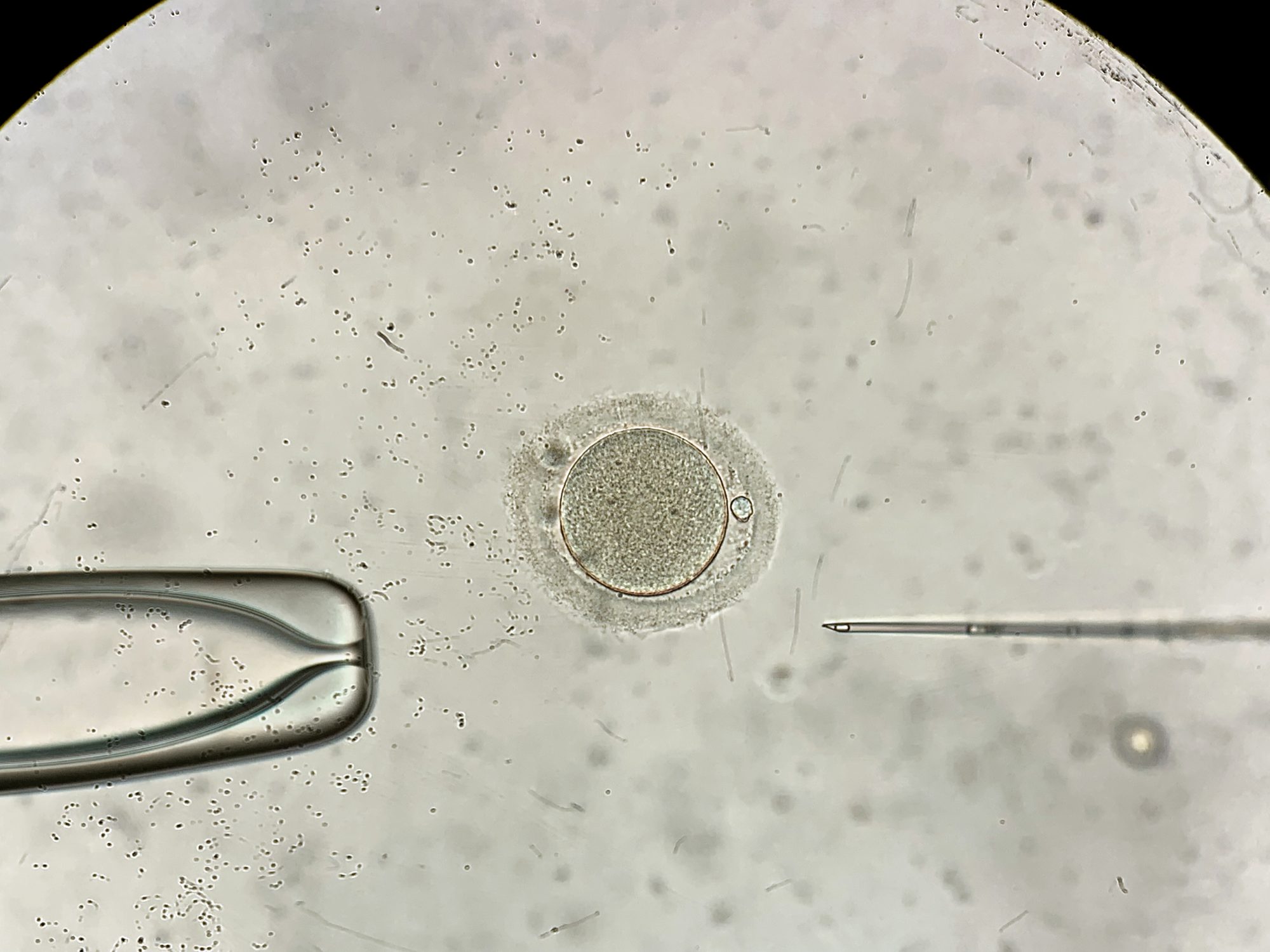 View through microscope at in vitro fertilization process