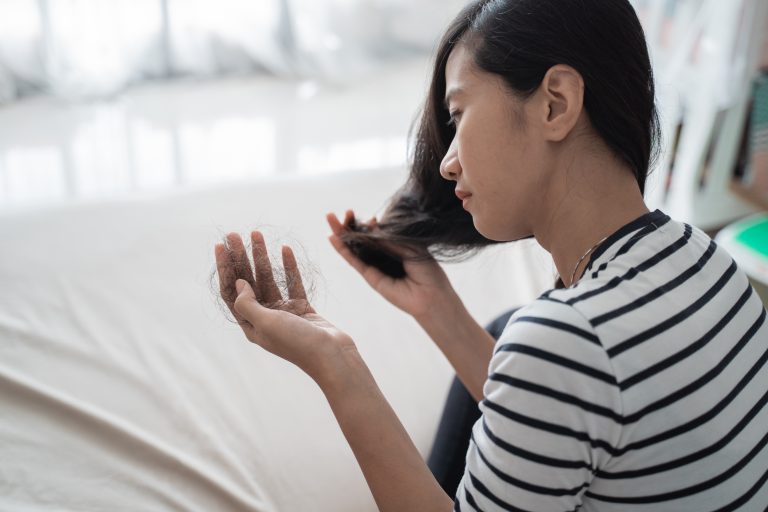 Woman experiencing hair loss