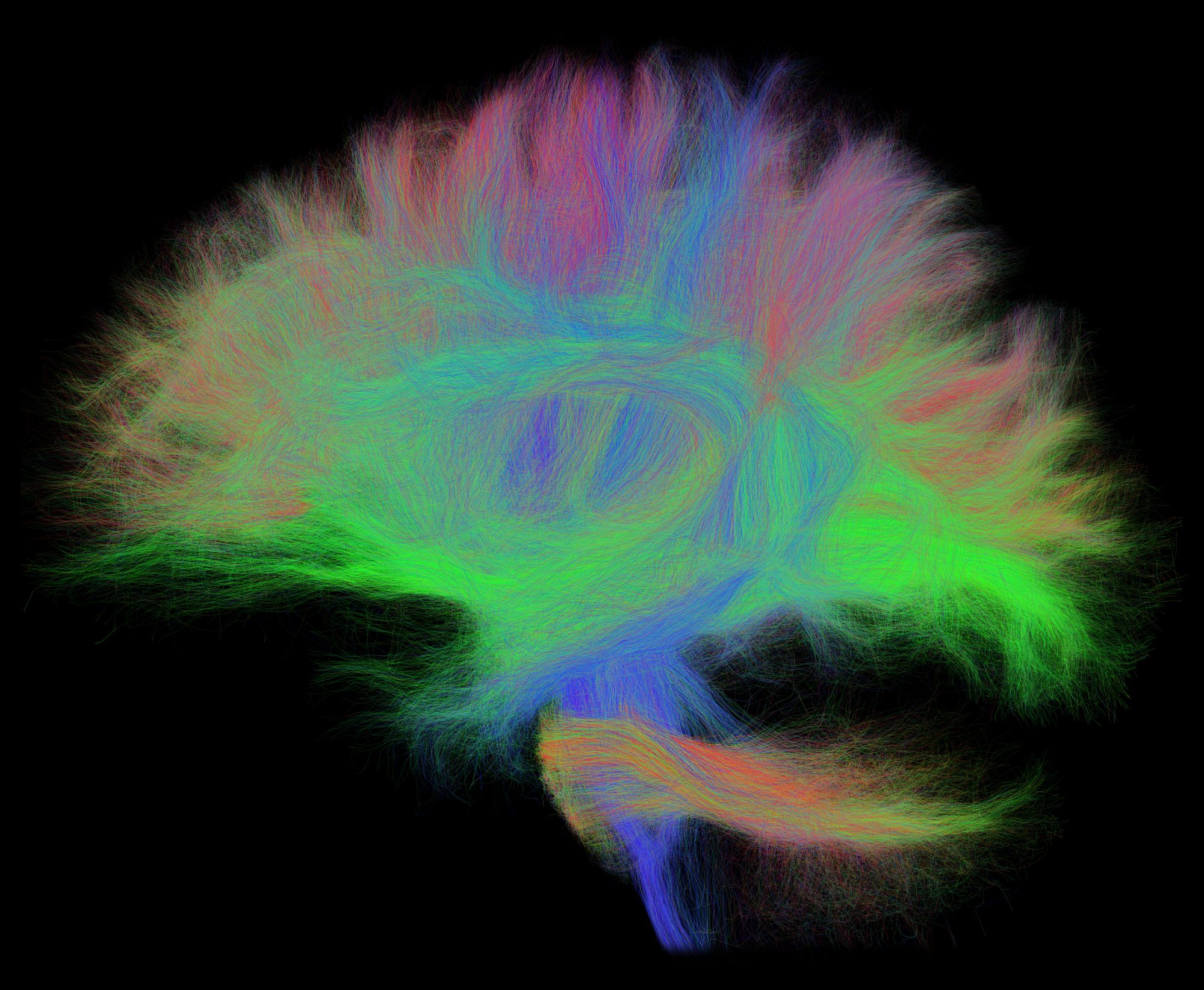 brain image with white matter