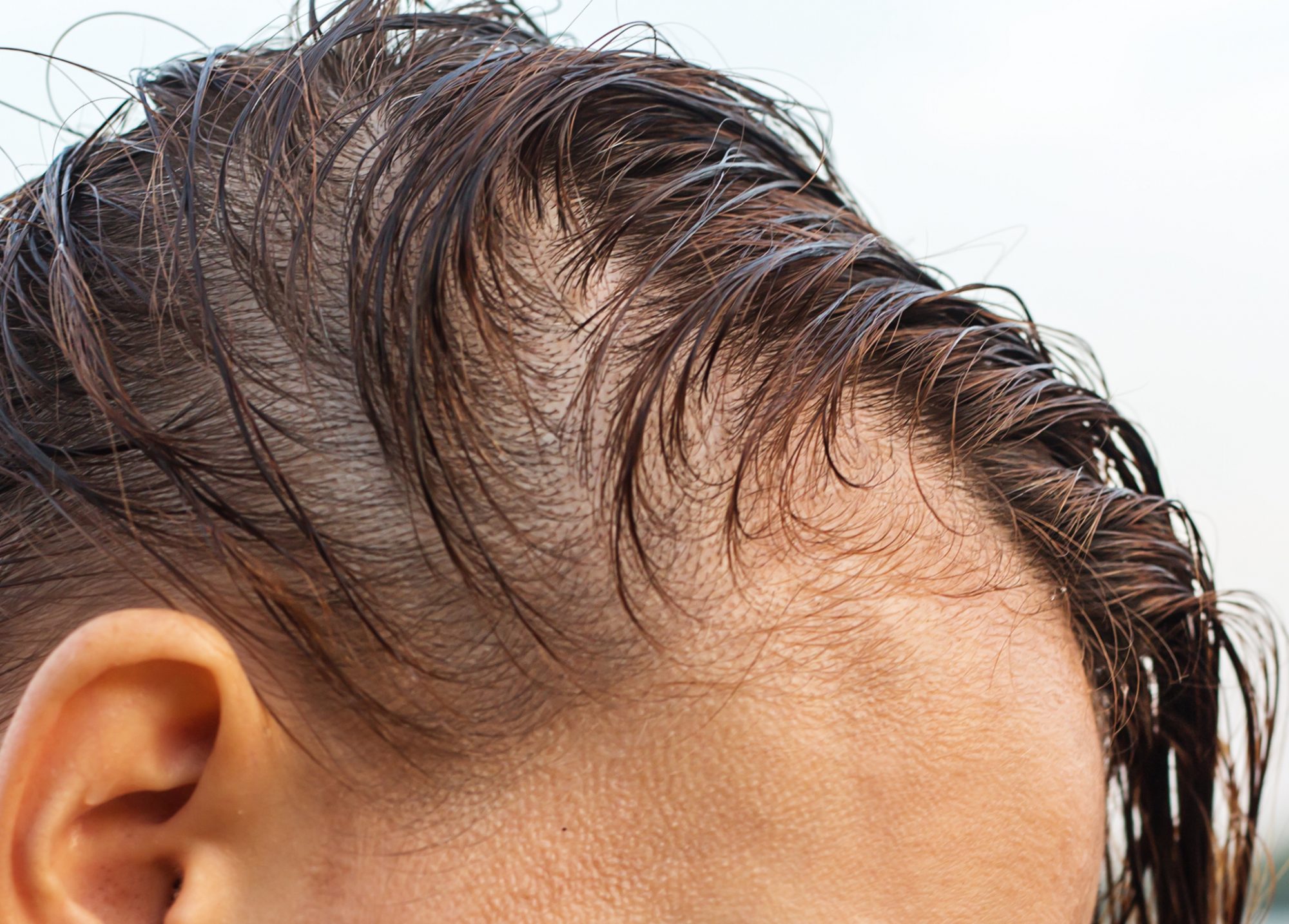 SCUBE3 as a treatment for hair loss and alopecia