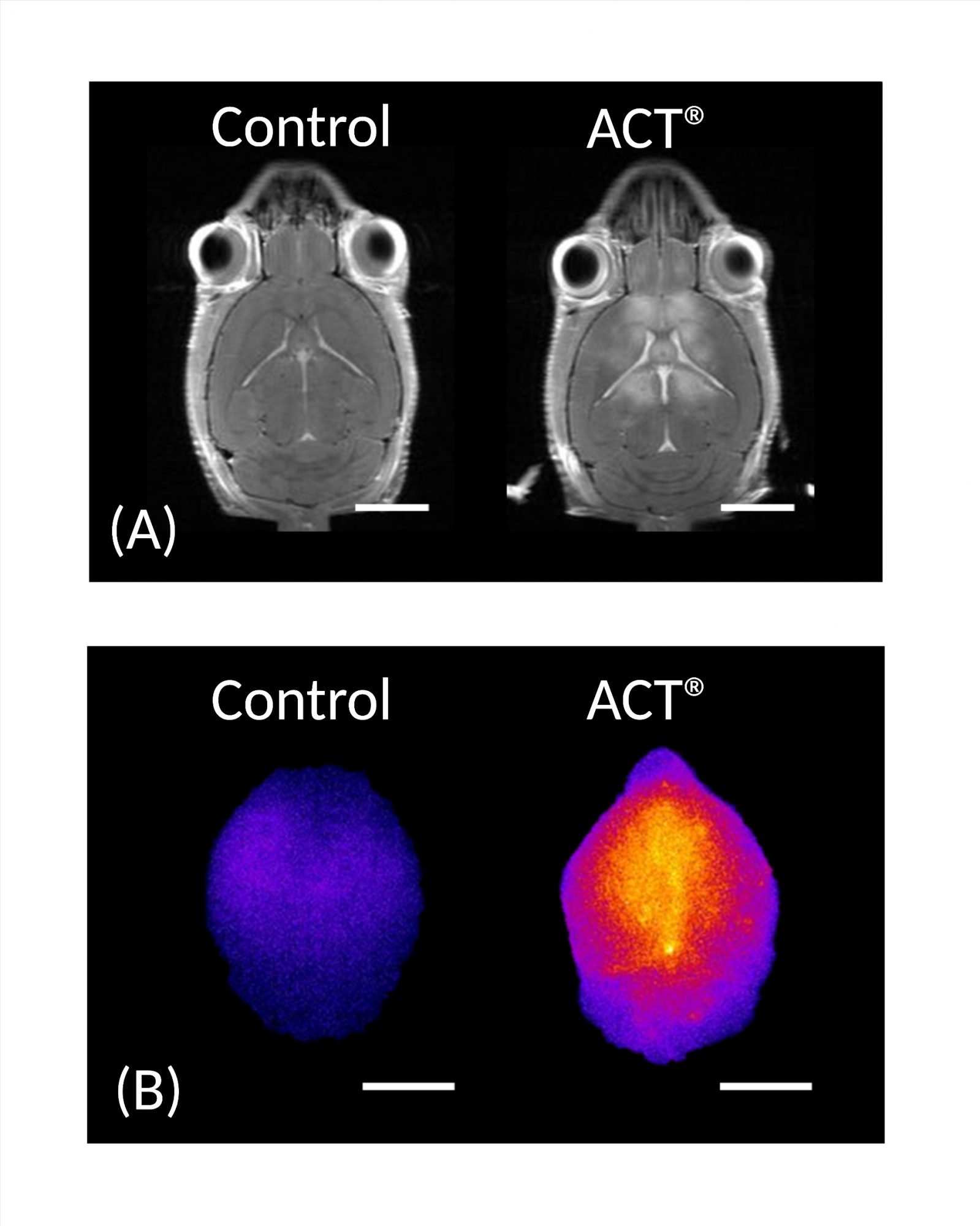 Acoustic Cluster Therapy