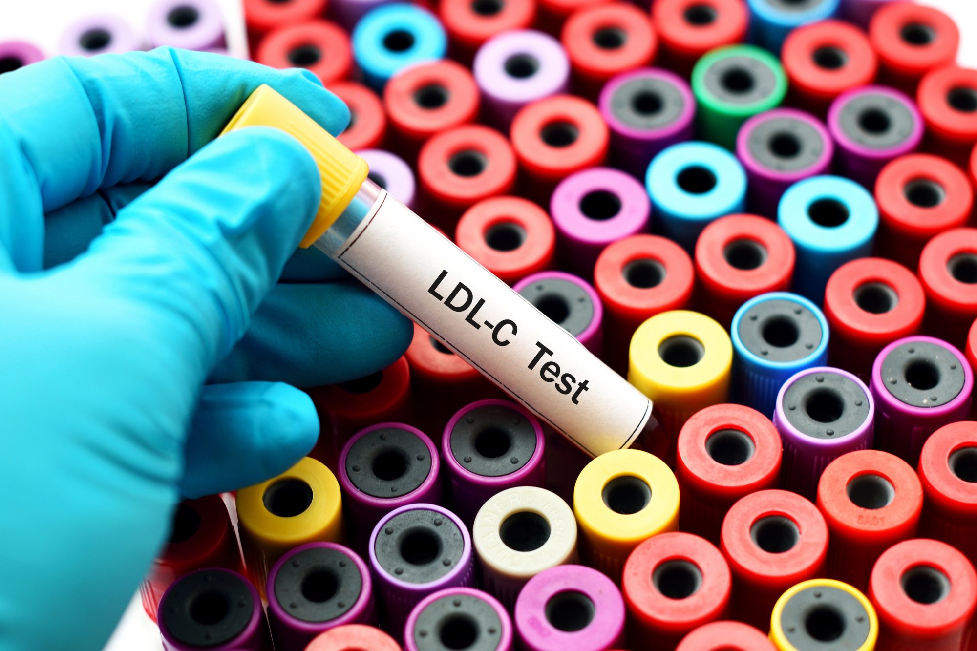 Blood for LDL cholesterol test