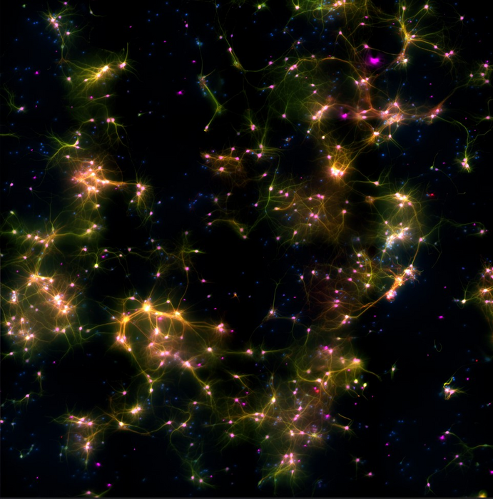 MICROSCOPY IMAGE OF NEURAL CELLS WHERE FLUORESCENT MARKERS SHOW DIFFERENT TYPES OF CELLS. GREEN MARKS NEURONS AND AXONS, PURPLE MARKS NEURONS, RED MARKS DENDRITES, AND BLUE MARKS ALL CELLS. WHERE MULTIPLE MARKERS ARE PRESENT, COLOURS ARE MERGED AND TYPICALLY APPEAR AS YELLOW OR PINK DEPENDING ON THE PROPORTION OF MARKERS, CREDIT CORTICAL LAB