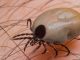 tick borne diseases