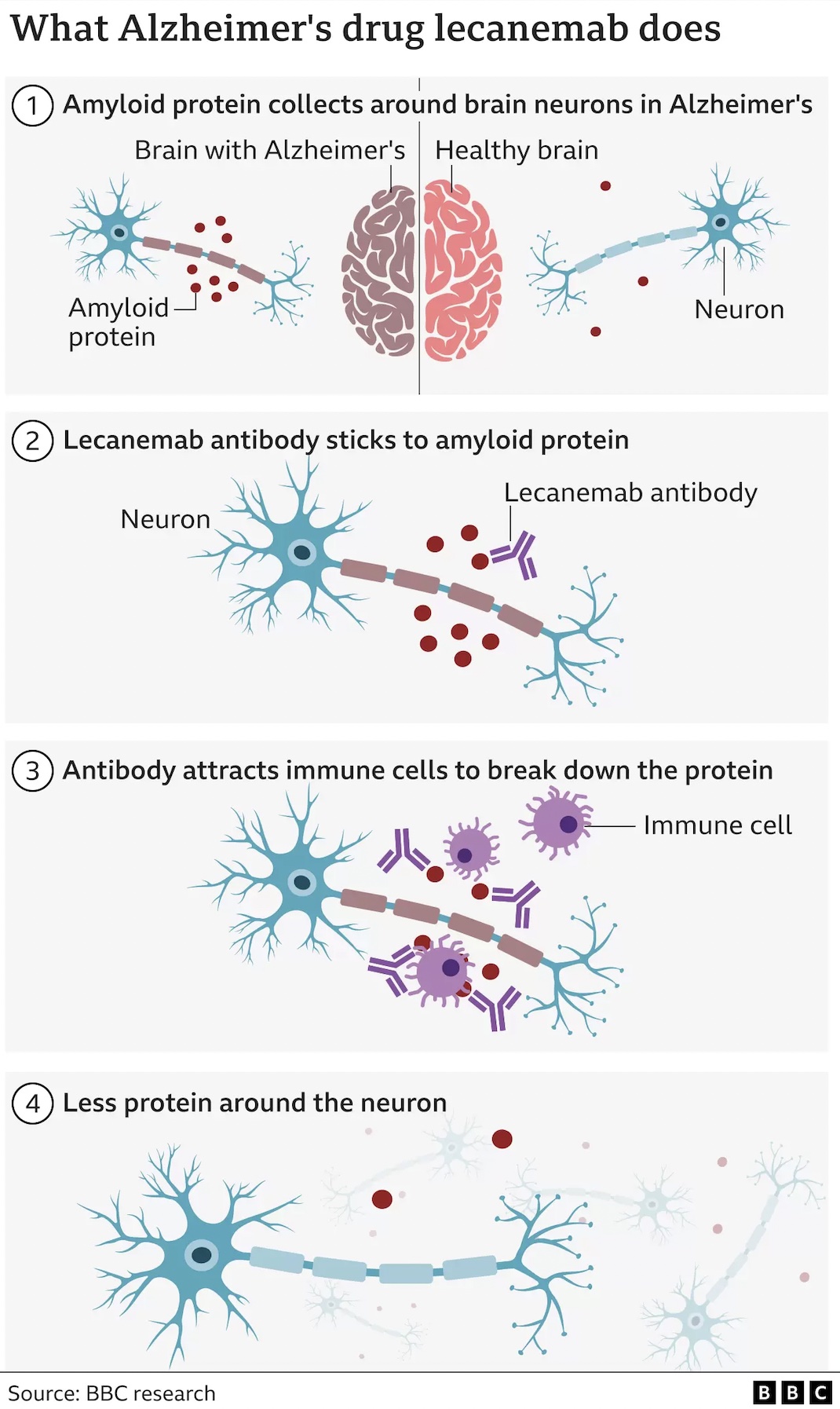 Longeveron Stock: Alzheimer's Phase Data Around The Corner, 44% OFF