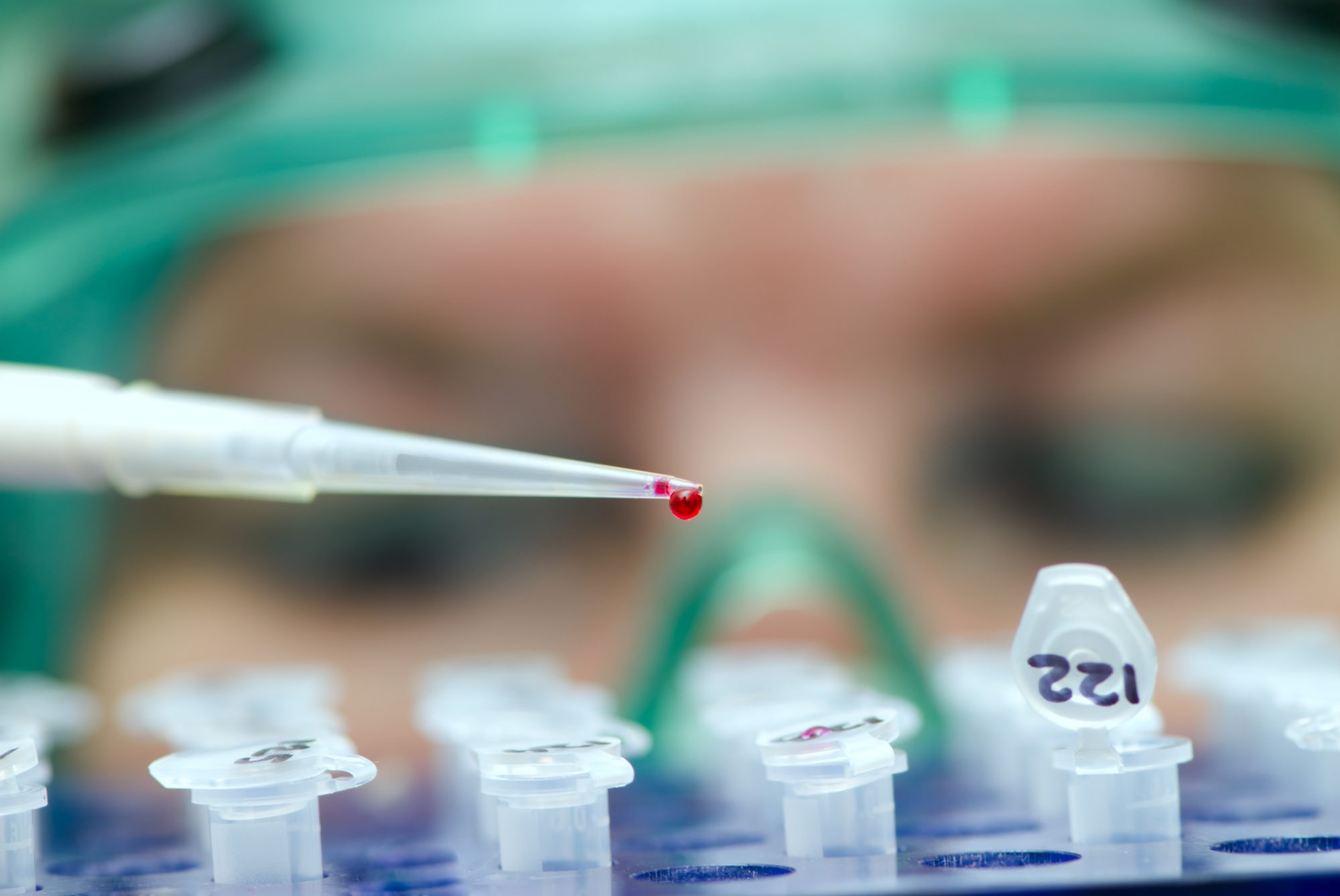 Laboratory assistant analyzing a dangerous infection