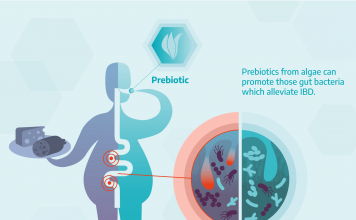 treatment for inflammatory bowel disease