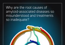 Root causes of amyloid-associated diseases