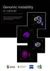 Genomic instability in cancer