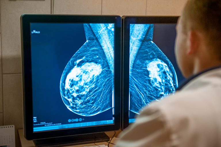 AI for mammography performance and quality enhancement