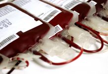 blood transfusion