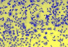 cervical cancer cells, genomic instability
