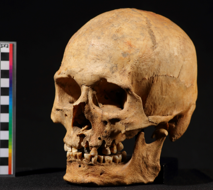 Ancient skull photographed against black background