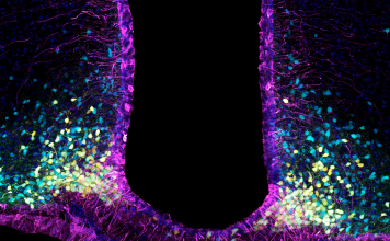 image showing tanycytes in purple and the neurons they interact with in the hypothalamus (yellow: appetite promoting neurons expressing neuropeptide Y (NPY); blue: appetite suppressing neurons expressing the propopiomelanocortin (POMC))