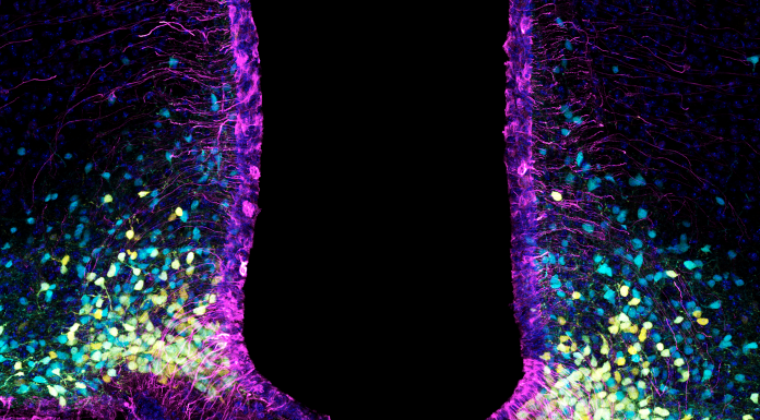 image showing tanycytes in purple and the neurons they interact with in the hypothalamus (yellow: appetite promoting neurons expressing neuropeptide Y (NPY); blue: appetite suppressing neurons expressing the propopiomelanocortin (POMC))