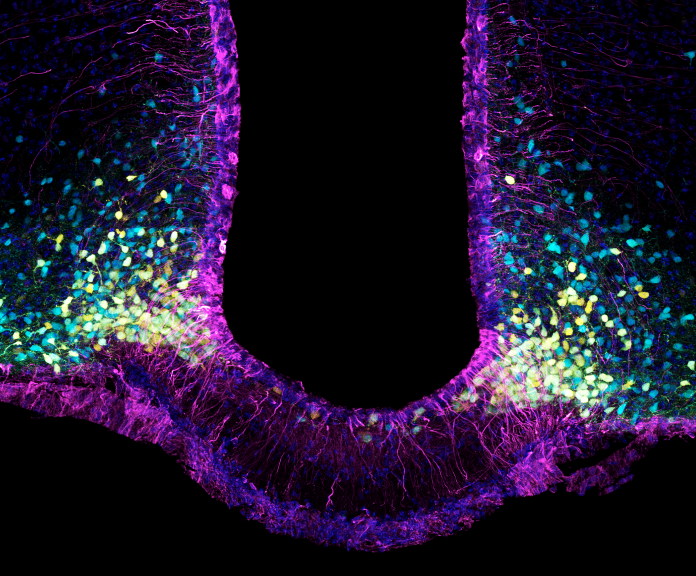 image showing tanycytes in purple and the neurons they interact with in the hypothalamus (yellow: appetite promoting neurons expressing neuropeptide Y (NPY); blue: appetite suppressing neurons expressing the propopiomelanocortin (POMC))
