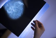 Xray breast scan mammogram