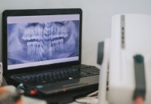 X-ray screen on laptop at dental office