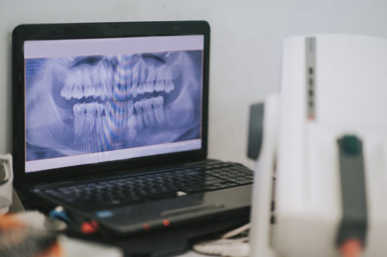 X-ray screen on laptop at dental office