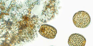 Diatoms, algae under microscopic view, phytoplankton, fossils, silica, golden yellow algae