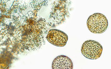 Diatoms, algae under microscopic view, phytoplankton, fossils, silica, golden yellow algae