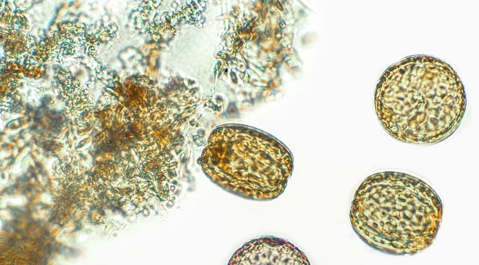 Diatoms, algae under microscopic view, phytoplankton, fossils, silica, golden yellow algae