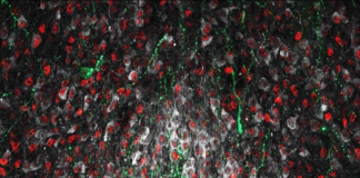 Image showing NO-producing neurons (white) interacting with other key neuronal populations shaping minipuberty in the hypothalamus (green: gonadotropin-releasing hormone neurons (GnRH), red: estrogen receptor-alpha expressing neurons (Erα)) https://doi.org/10.1016/j.freeradbiomed.202 2.11.040, minipuberty