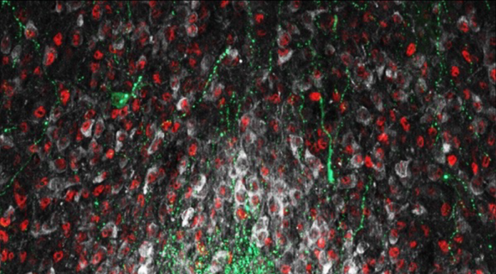 Image showing NO-producing neurons (white) interacting with other key neuronal populations shaping minipuberty in the hypothalamus (green: gonadotropin-releasing hormone neurons (GnRH), red: estrogen receptor-alpha expressing neurons (Erα)) https://doi.org/10.1016/j.freeradbiomed.202 2.11.040, minipuberty