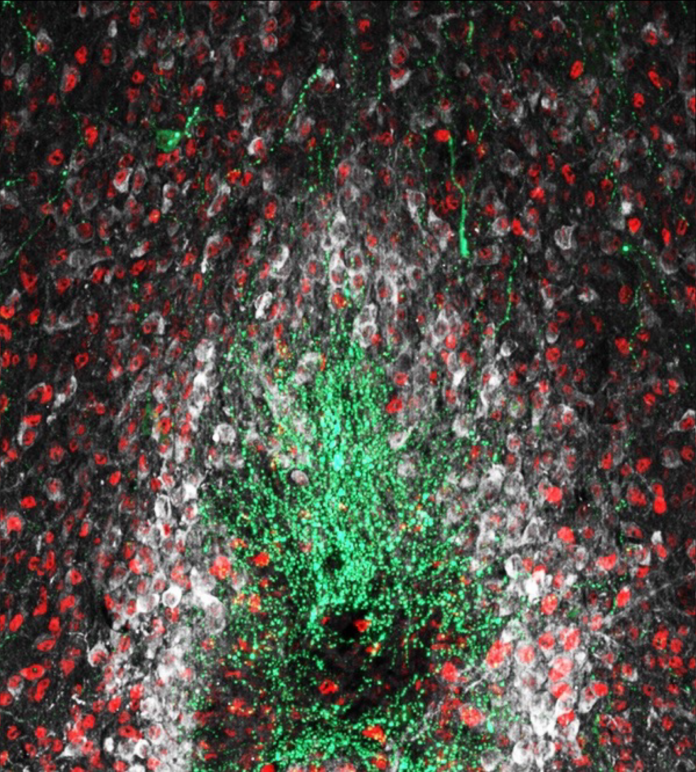 Image showing NO-producing neurons (white) interacting with other key neuronal populations shaping minipuberty in the hypothalamus (green: gonadotropin-releasing hormone neurons (GnRH), red: estrogen receptor-alpha expressing neurons (Erα)) https://doi.org/10.1016/j.freeradbiomed.202 2.11.040, minipuberty