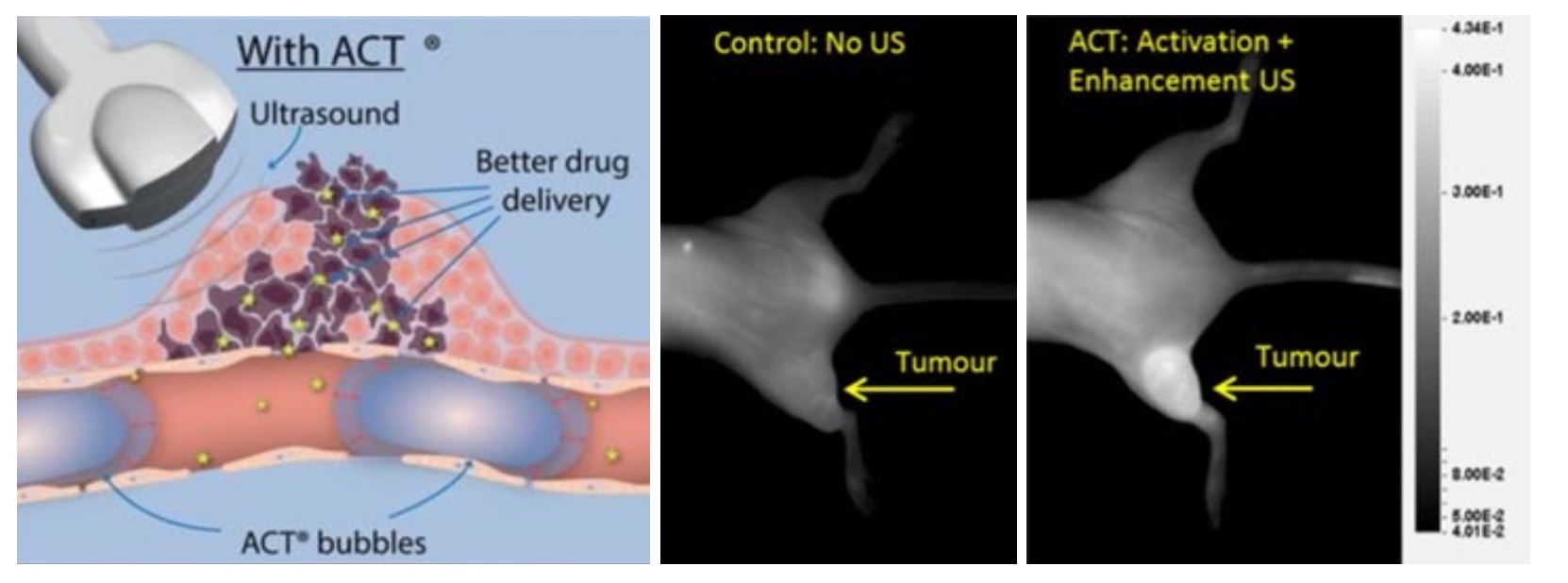Figure 1: ACT works locally by aiming ultrasound directly at the tumor and activating systemically injected microcluster. To the right it can be seen how ACT can increase the delivery of a fluorescent model drug in a tumor on the leg of a mouse (Wamel 2016).