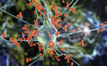 Antibodies attacking neuron, 3D illustration. Concept of autoimmune neurologic diseases