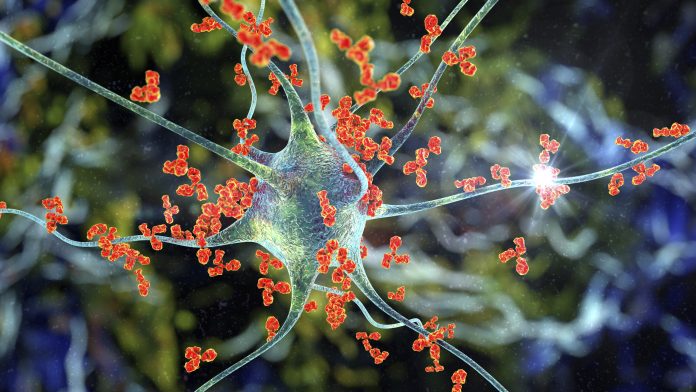 Antibodies attacking neuron, 3D illustration. Concept of autoimmune neurologic diseases