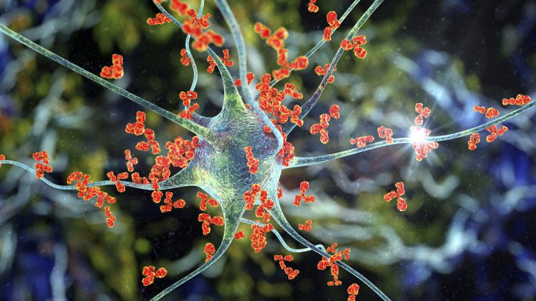 Antibodies attacking neuron, 3D illustration. Concept of autoimmune neurologic diseases