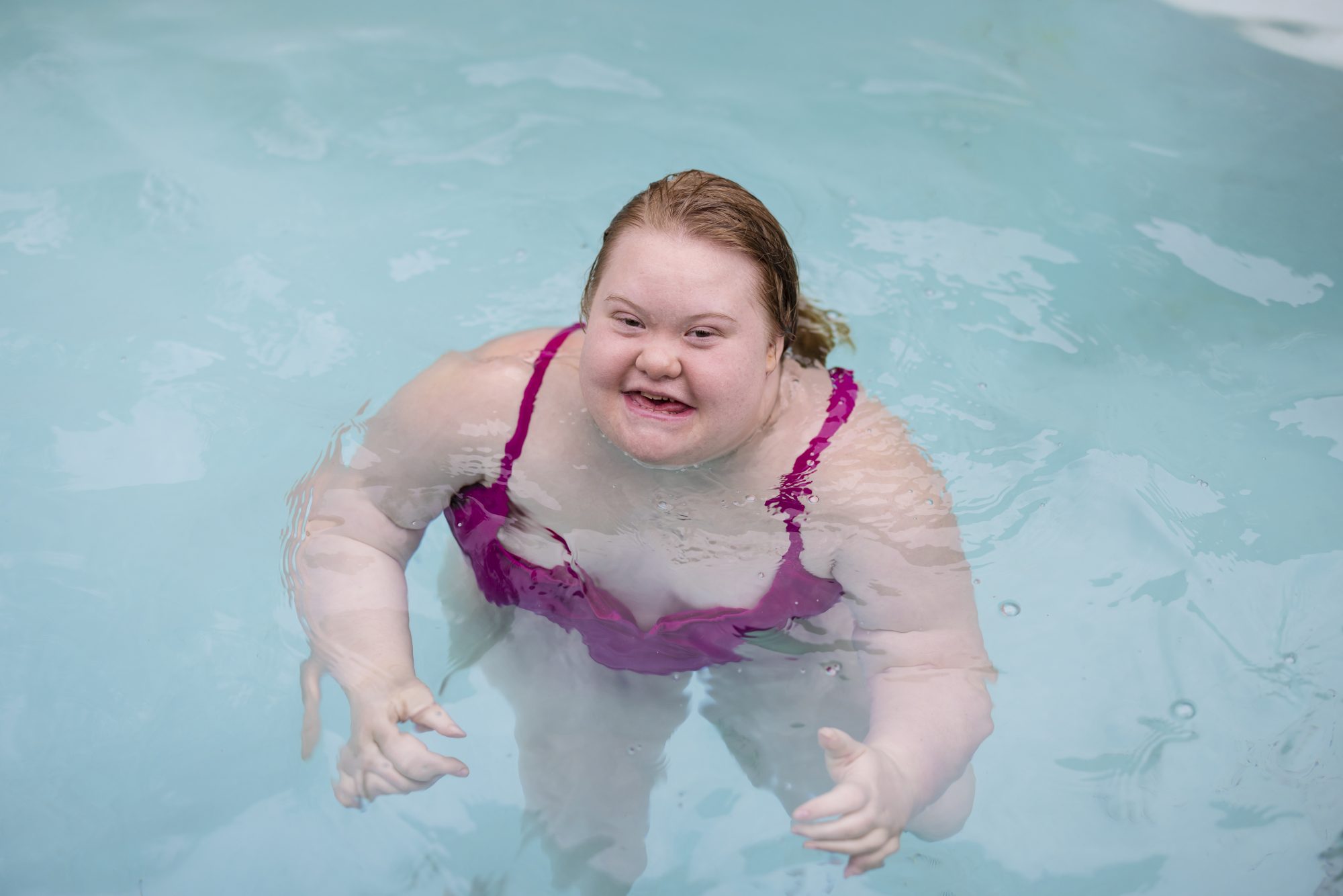A girl with Down syndrome swimming in a pool