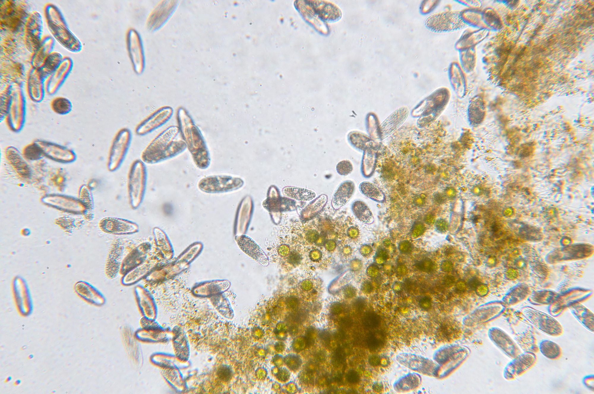 Tetrahymena is a genus of unicellular ciliated protozoan and Bacterium under the microscope