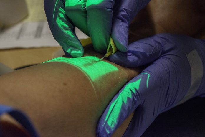 Gloved nurse using a butterfly setup and vein finder to “highlight” blood vessels on a patient’s arm and insert a hypodermic needle for an intravenous infusion.
