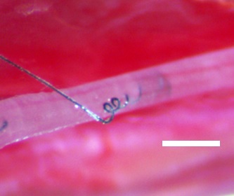 Carbon nanotube yearns implanted in a rodent vagus nerve.