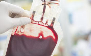 close up blood bag in laboratory medical concept.