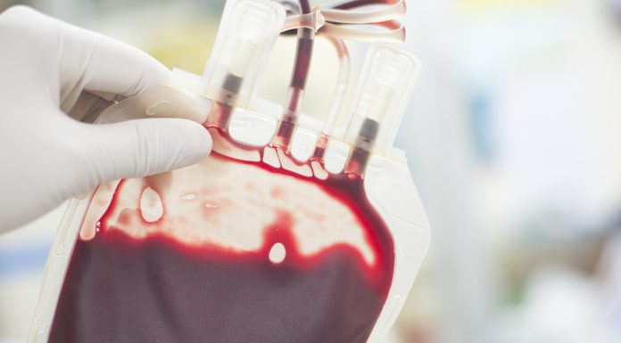 close up blood bag in laboratory medical concept.