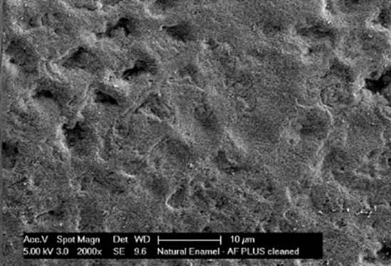 Fig 1a and 1b: Microscopic view of the natural roughness of enamel on the bacteria level