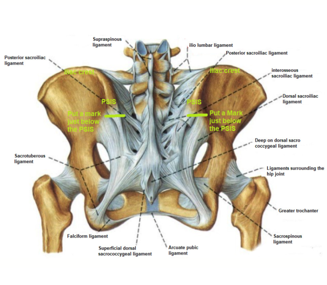 Figure 2: the sacroiliac joints seen from the back. Notice the multitude of ligaments holding the SI joints compared to those surrounding the hip joints., Observe the location of the PSISs and where to put the mark indicating their level.