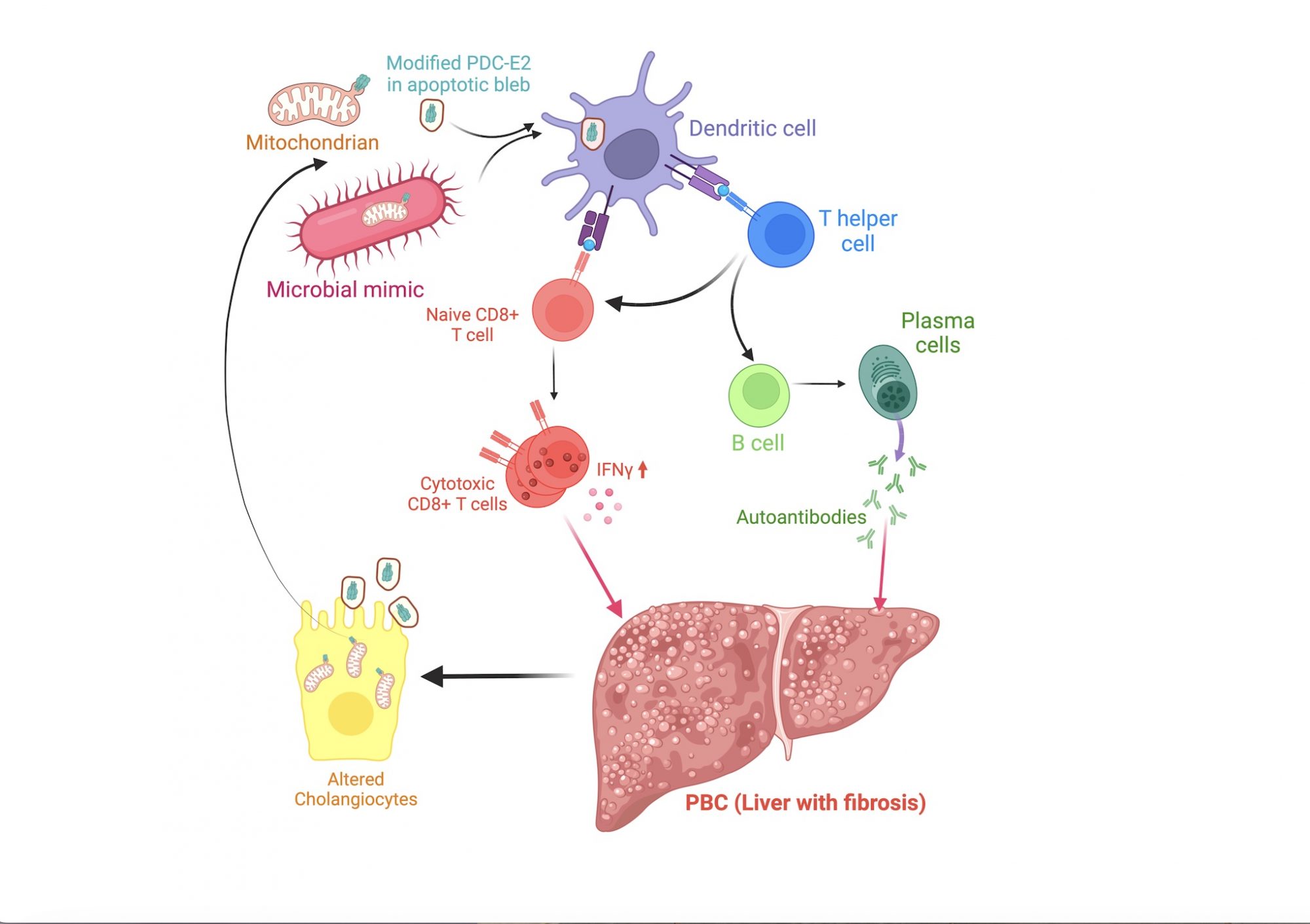 Figure 1. Immune dysregulation in PBC. Exposure to an environmental mimic of a modified PDC-E2 autoantigen leads to a multilineage immune response targeted at biliary epithelial cells. Created with BioRender.com