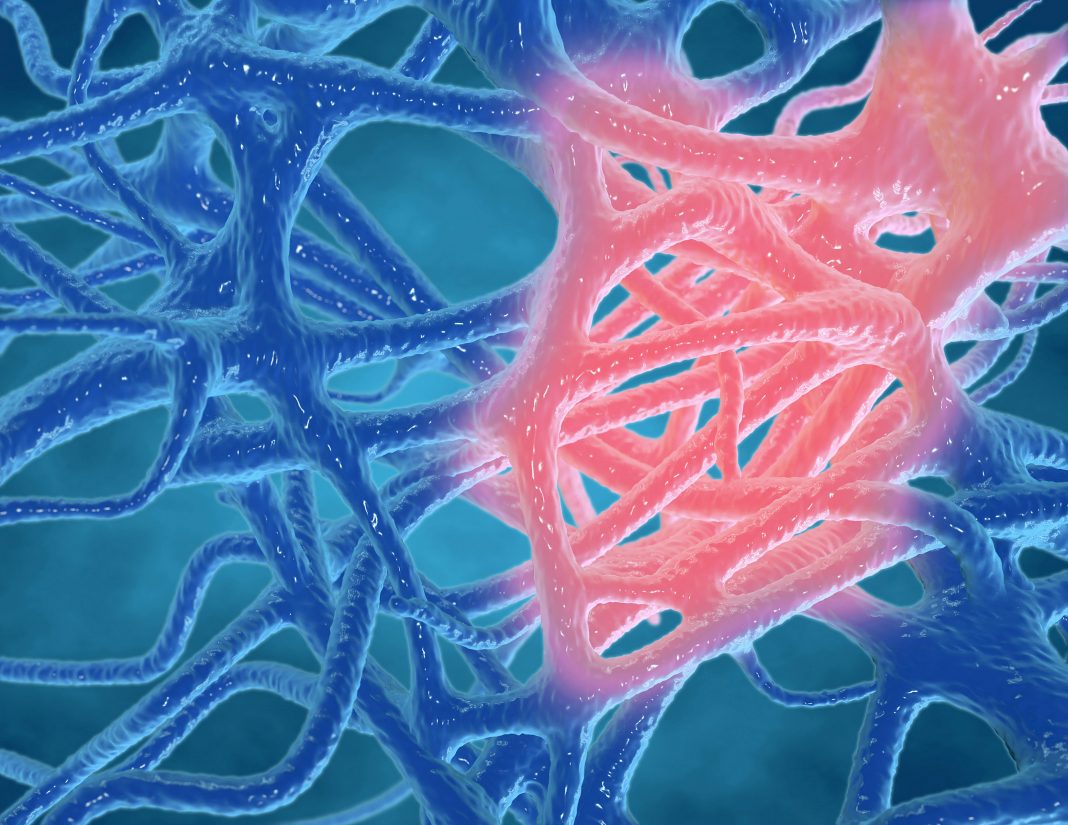 Inflammation concept, inflamed human tissues 3d rendering.