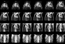 Thoracoabdominal CT