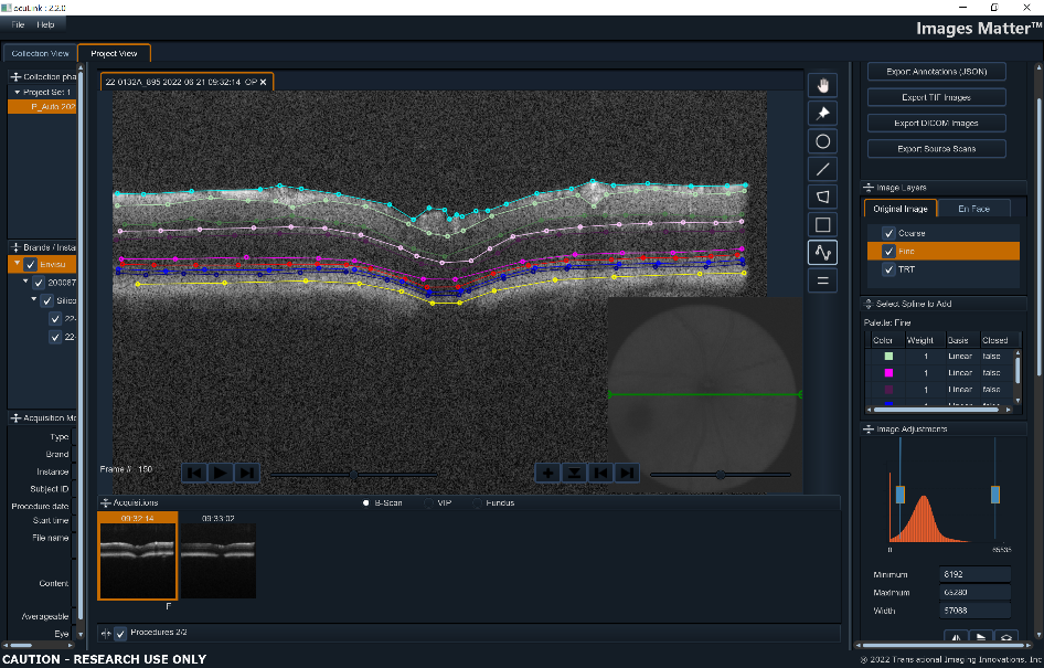 ocuLinkTM Image Curation Visualization and Annotation Application