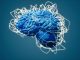 World map textured human brain with connections.