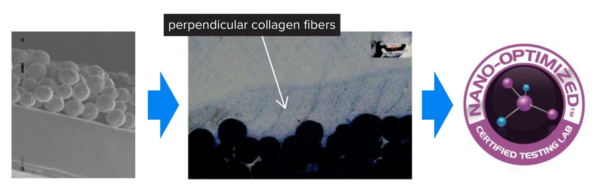 Figure 3: Prof. Webster and his team have coined the term “Nano-OptimizedTM” which uses AI to predict how well a patient’s immune system will accept or reject a medical device suggesting an optimal nanotopography to achieve its goal. In this specific example, nanotextures were placed on materials used for tendon fixation regrowing tendons off of their surface to improve implant function