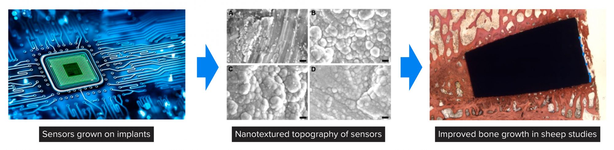 Figure 4: Kalnar Technologies is manufacturing sensors off of implants that use AI to predict a patient response to an implant, control patient response based on that information, and communicate such information to a clinician to eliminate implant failure for the lifetime of the patient. The example shown here includes using atomic layer deposition (ALD) to grow sensors off of implants which have a nanotexture that increases bone growth in a spinal sheep model after 12 weeks