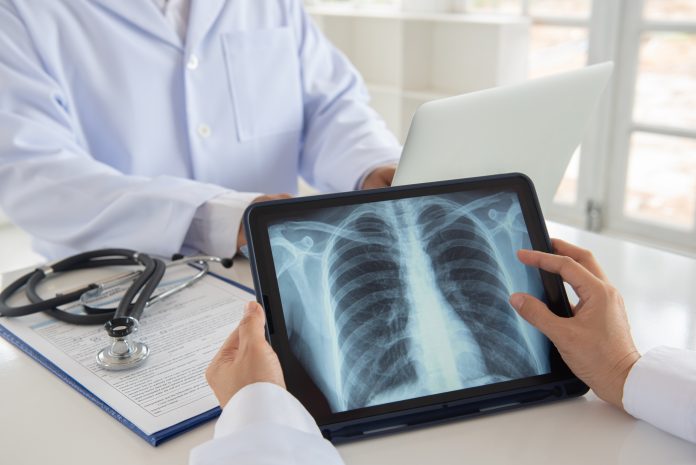 doctor x-ray lungs on a ipad with patient sitting opposite